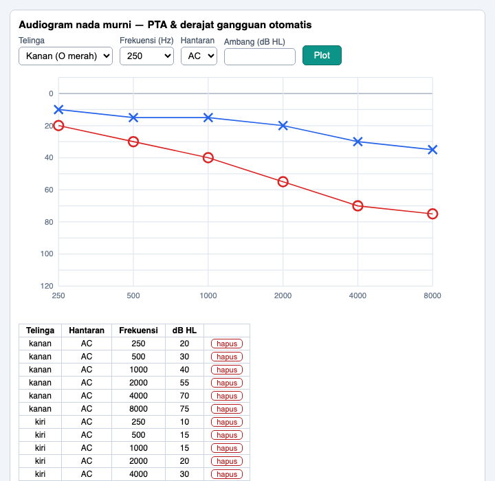Audiogram THT dengan simbol standar; PTA & derajat gangguan otomatis