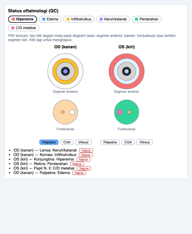 Status oftalmologi OD/OS: segmen anterior & funduskopi interaktif